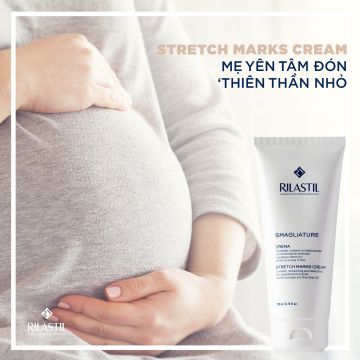 CÓ STRETCH MARKS CREAM - MẸ YÊN TÂM ĐÓN ‘THIÊN THẦN NHỎ