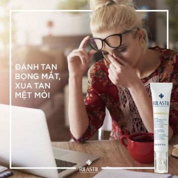 ĐÁNH TAN BỌNG MẮT, XUA TAN MỆT MỎI