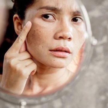 6 tác hại khi không thoa kem chống nắng đều đặn