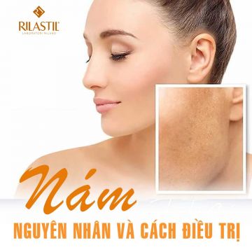 NÁM - NGUYÊN NHÂN VÀ CÁCH ĐIỀU TRỊ