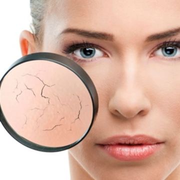 7 bí quyết giúp bạn tránh khô da trong mùa lạnh
