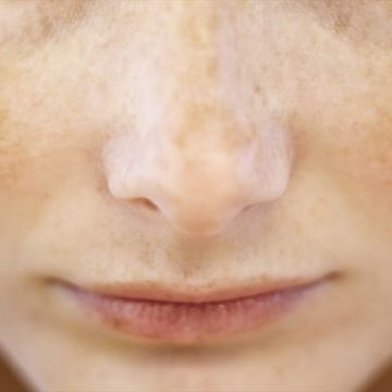 Cách chăm sóc da cho người thường xuyên thức khuya