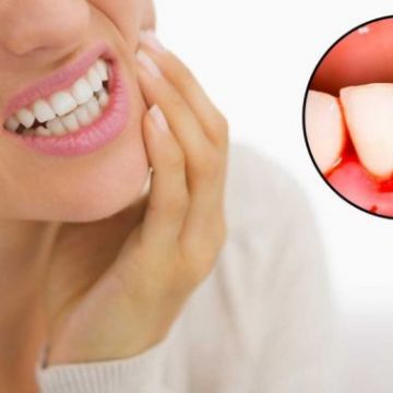 Dấu hiệu cơ thể bị thiếu hụt vitamin C