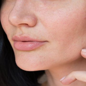 Bí quyết chăm sóc da hỗn hợp chuẩn nhất