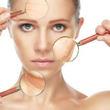 Da hỗn hợp cần có cách chăm sóc riêng