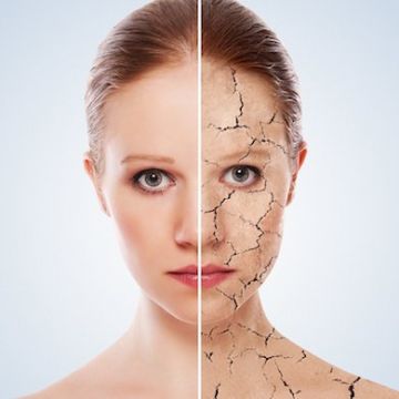 Một số mẹo chăm sóc và chọn mỹ phẩm cho làn da thiếu dầu và thiếu ẩm