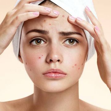 Cách đẩy lùi mụn phù hợp cho mọi loại da
