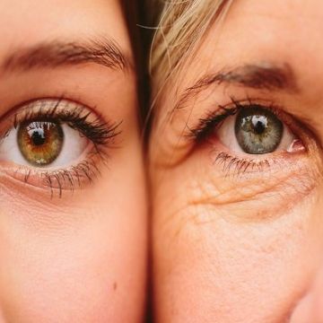 Cách đơn giản ngăn ngừa hình thành nếp nhăn