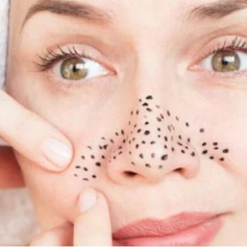 Loại bỏ 5 thói quen bất cẩn có thể gây mụn đầu đen