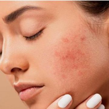 5 yếu tố ảnh hưởng xấu đến làn da của bạn