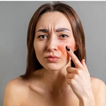 Bí quyết skincare dành cho da nhạy cảm