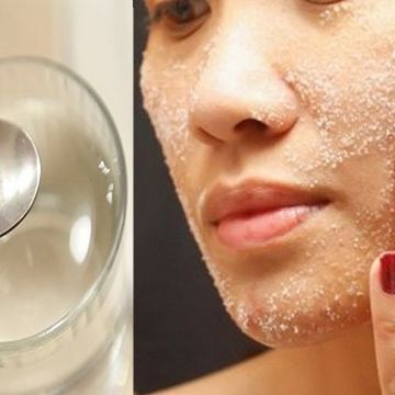 3 cách trị sẹo thâm tại nhà bạn cần ghi nhớ