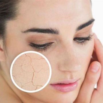 Bí quyết chăm sóc da khô, bạn cần học ngay hôm nay