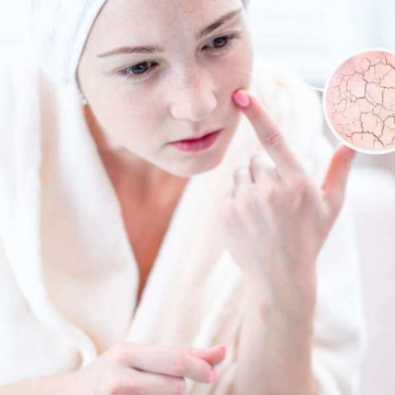 Các bước chăm sóc da khô chị em nên biết