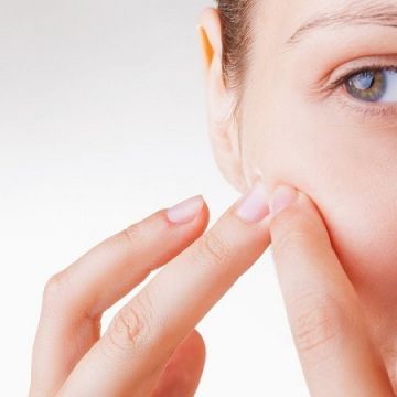 2 cách trị mụn ẩn dưới da chưa bao giờ dễ như thế