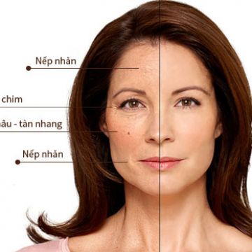 4 điều bạn buộc phải làm ngay hôm nay để da trẻ mãi tuổi 20