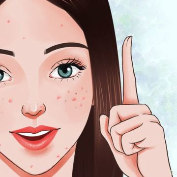 Cách chọn kem chống nắng cho da mụn
