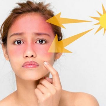 Bạn đã biết cách chống tia UV?