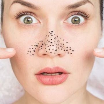 Da mụn có nên tẩy tế bào chết không?