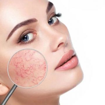 Vì sao da mặt mỏng, yếu dần đi theo thời gian?