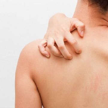 Vì sao lo lắng và ngứa ngáy xảy ra đến cùng lúc?