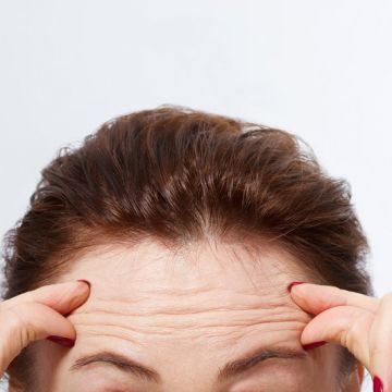Hạn chế nếp nhăn vùng trán