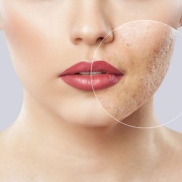 Da xỉn màu, thiếu sức sống: Nguyên nhân và cách khắc phục