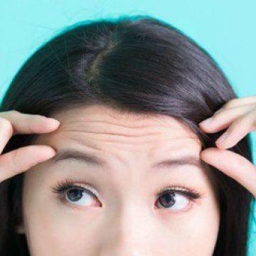 Nguyên nhân xuất hiện nếp nhăn ở trán