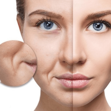 Sự hình thành các nếp nhăn khóe miệng