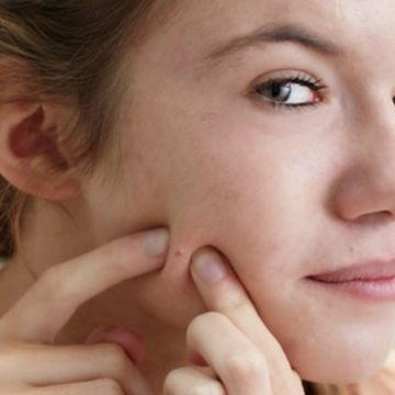 Sai lầm khiến làn da bị tổn thương nghiêm trọng