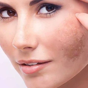 Làn da xuống cấp vì lý do không ngờ