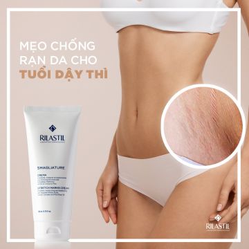 MẸO CHỐNG RẠN DA CHO TUỔI DẬY THÌ